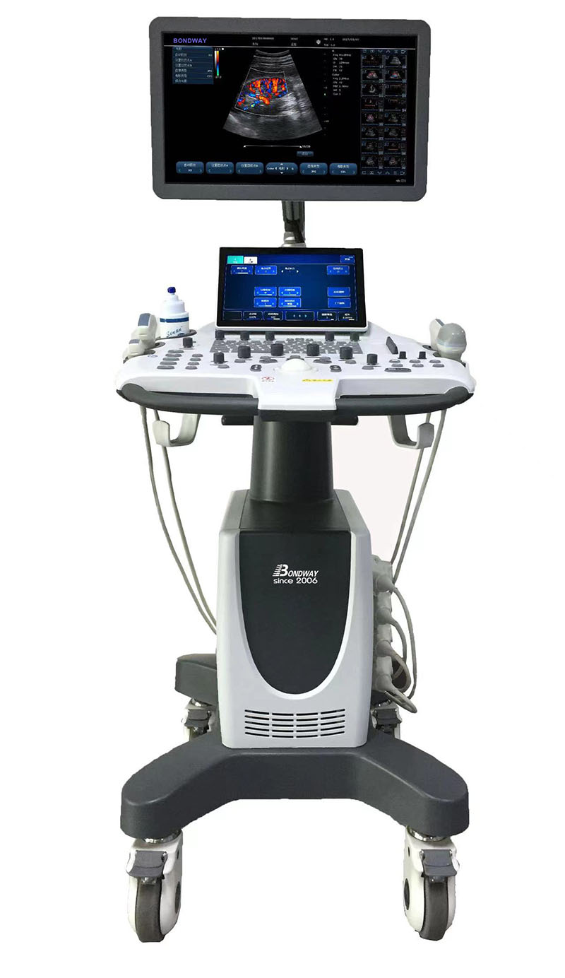 Color Doppler diagnostic ultrasound system Bondway ES211