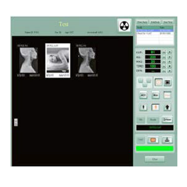 BPM-PR400 Portable X Ray Machine