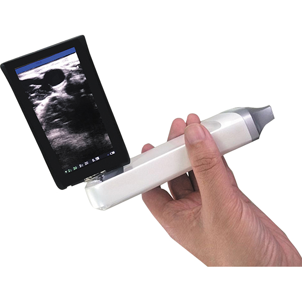 Scanner à ultrasons sans fil à sonde linéaire BPM-HBU5X avec écran intégré