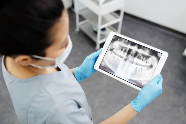 حقائق سيرفال حول معدات الأشعة السينية للأسنان