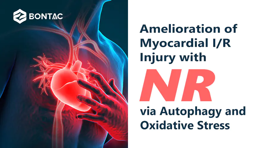 Amelioration of Myocardial I/R Injury with NR via Autophagy and Oxidative Stress