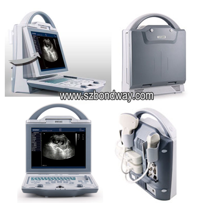 Escáner de ultrasonido de diagnóstico digital en blanco y negro BW540