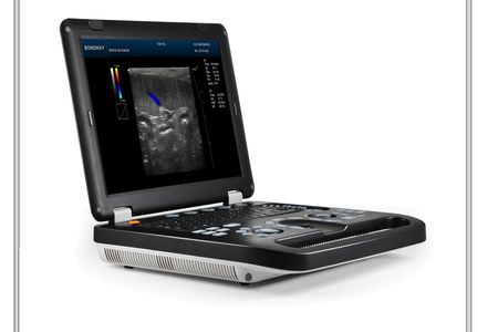 sistema de diagnóstico por imágenes por ultrasonido