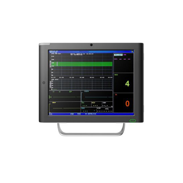 BPM-FM1503 Fetal Monitor