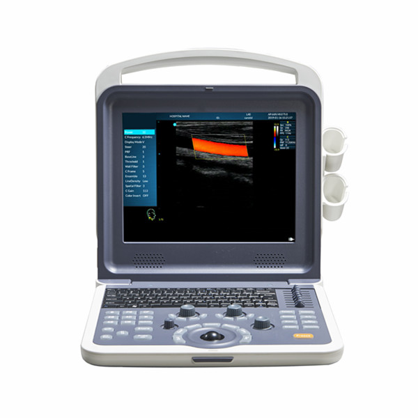 BPM-CU7 Most Economical Color Doppler Ultrasound