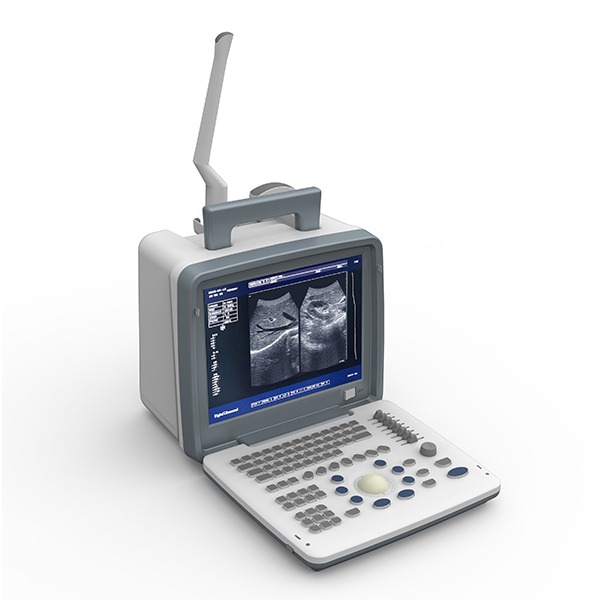 BPM-CU11 3D 4D Color Ultrasound 