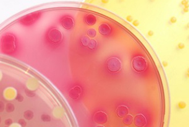 Need for Biocides Antimicrobial Agents & Antimicrobials, Types & Selection Tips