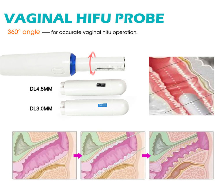 Konmison 2 in1 9D Hifu High Intensity Focused Ultrasound Vaginal Machine - To Vaginal