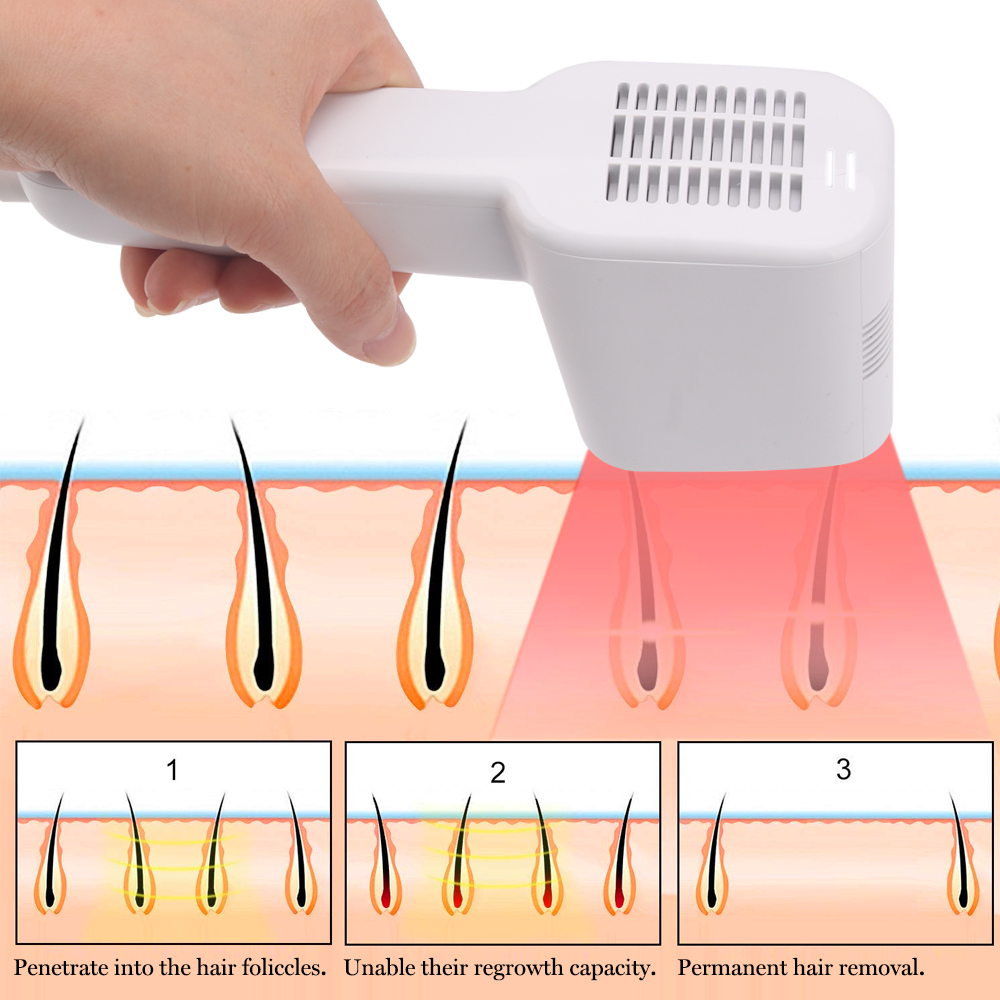 Home Use OPT Device IPL Permanent Hair Removal Machine - Principle