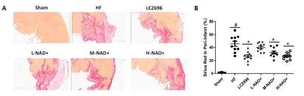 Účinky NAD+ na srdcovú fibrózu pri periinfarkte u potkanov SD