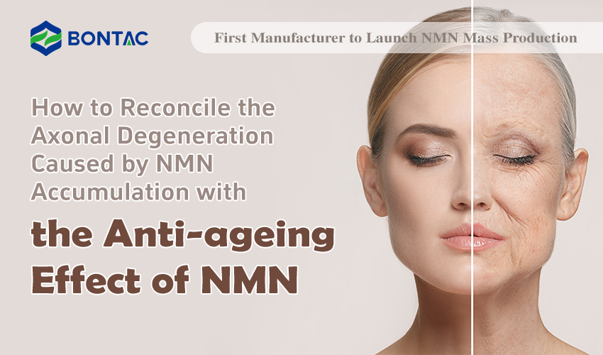 Jak pogodzić zwyrodnienie aksonów spowodowane akumulacją NMN z działaniem przeciwstarzeniowym NMN