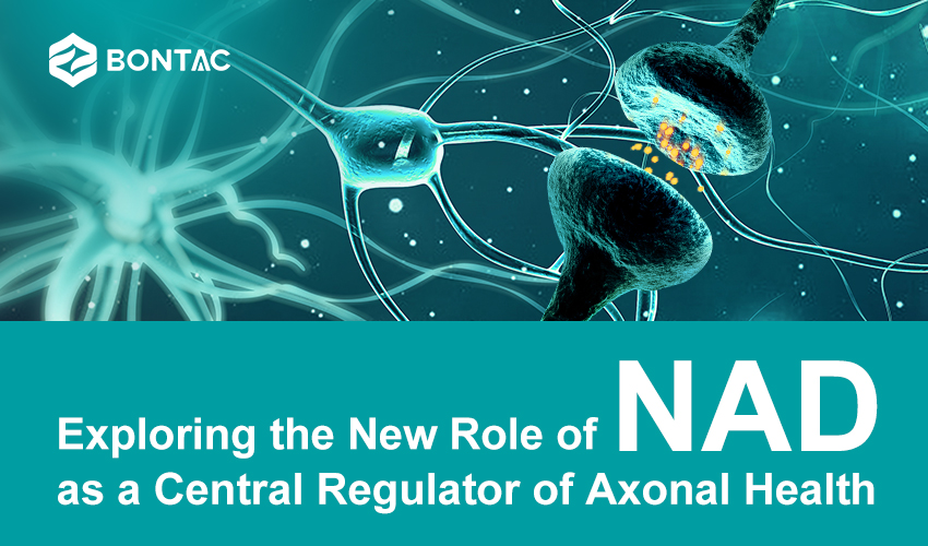 Skúmanie novej úlohy NAD ako centrálneho regulátora axonálneho zdravia