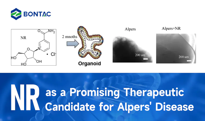 NR jako slibný terapeutický kandidát na léčbu Alperovy choroby