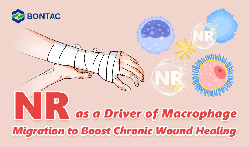NR as a Driver of Macrophage Migration to Boost Chronic Wound Healing